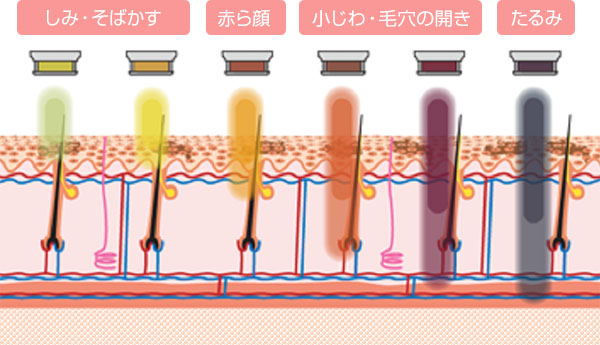 BBL波長の違いによる様々な対応疾患の表